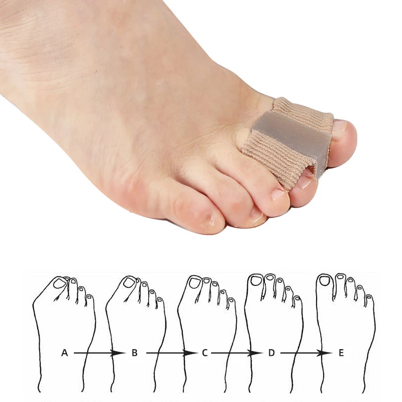 Separadores de dedos de joanet - Toe Separator Silicon avaliação e preço